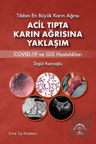 Acil Tıpta Karın Ağrısına Yaklaşım | Kitap Ambarı