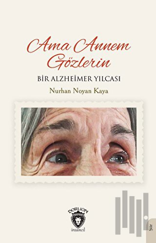 Ama Annem Gözlerin Bir Alzheimer Yılcası | Kitap Ambarı