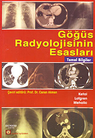 Göğüs Radyolojisinin Esasları | Kitap Ambarı