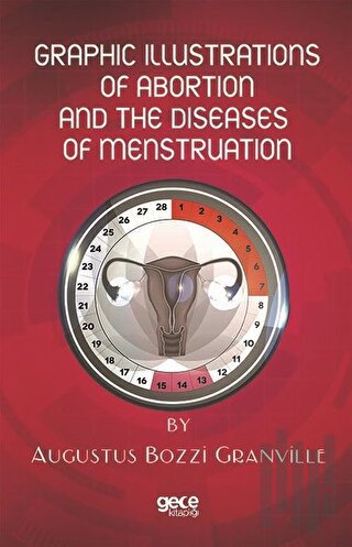 Graphic Illustrations Of Abortion And The Diseases Of Menstruation | K