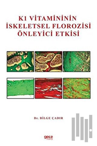 K1 Vitamininin İskeletsel Florozisi Önleyici Etkisi | Kitap Ambarı