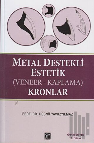 Metal Destekli Estetik (Veneer-Kaplama)Kronlar (Ciltli) | Kitap Ambarı