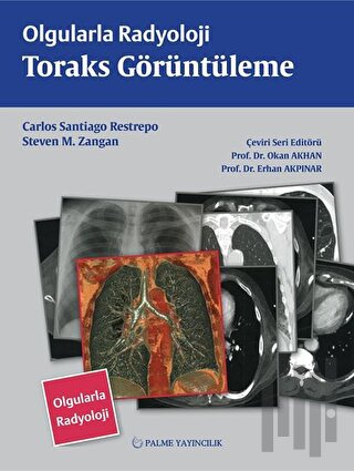 Olgularla Radyoloji Toraks Görüntüleme | Kitap Ambarı