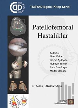 Patellofemoral Hastalıklar | Kitap Ambarı