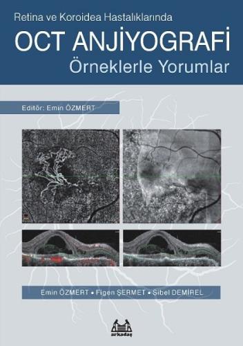 Retina ve Koroidea Hastalıklarında OCT Anjiyografi | Kitap Ambarı