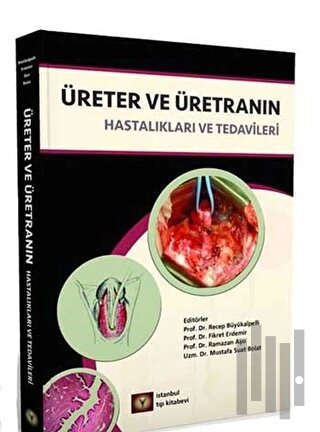 Üreter ve Üretranın Hastalıkları ve Tedavileri | Kitap Ambarı